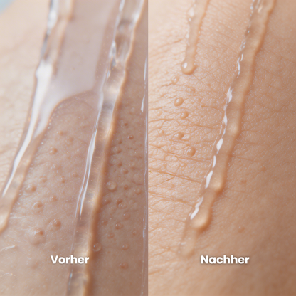 Virella - Duschfilter