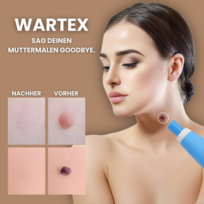 WARTEX